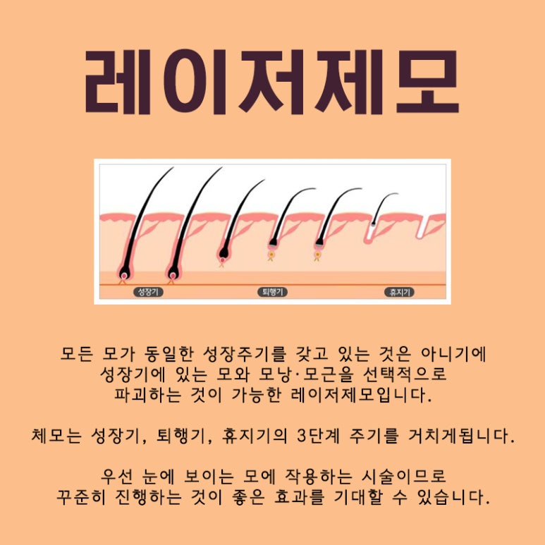 톡스앤필 남성 레이저 제모 관련 이미지 2