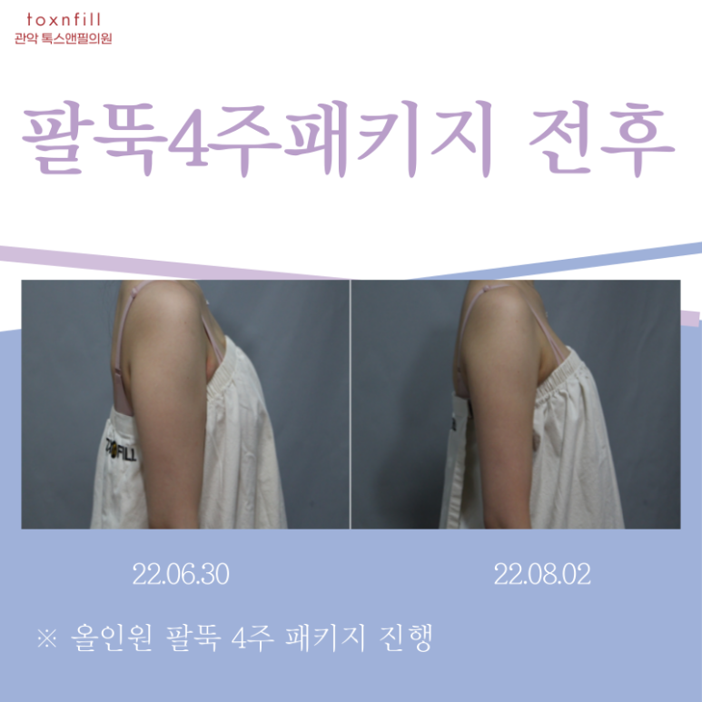 사당역다이어트 요즘 어떻게 다이어트하시나요? 관련 이미지 3