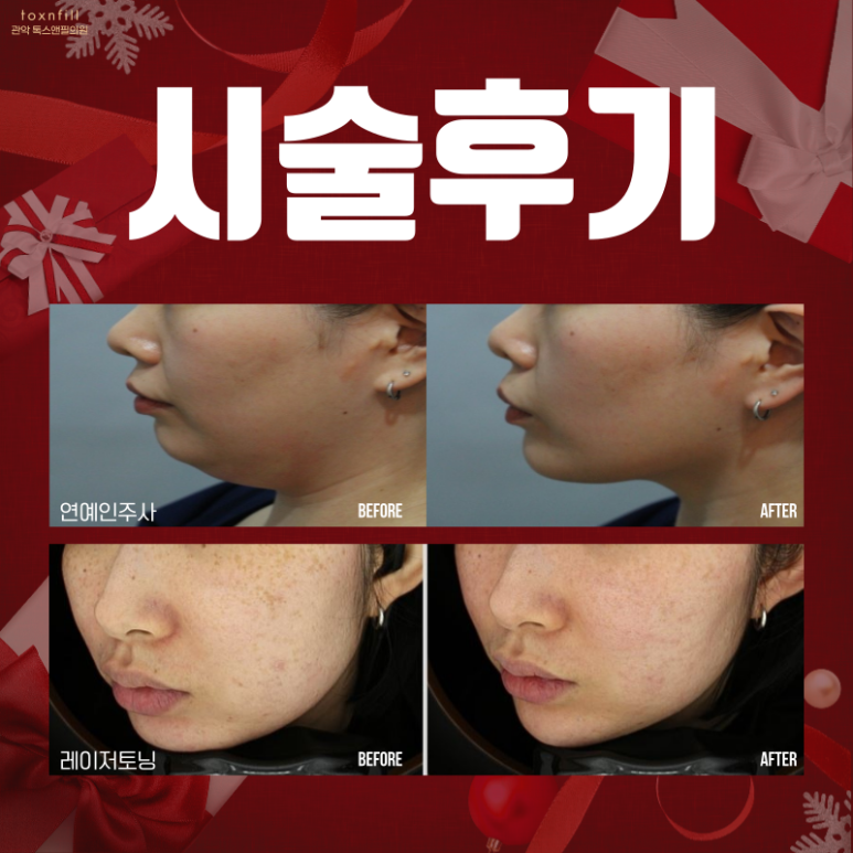 12月 톡스앤필 관악서울대점만의 특별한 연말이벤트 관련 이미지 4