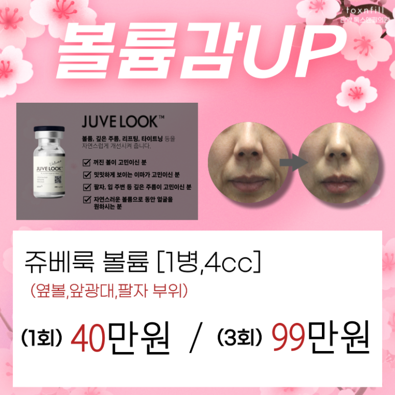 [톡스앤필서울대점] 4.2~4.13 봄맞이 이벤트 도입! 관련 이미지 5