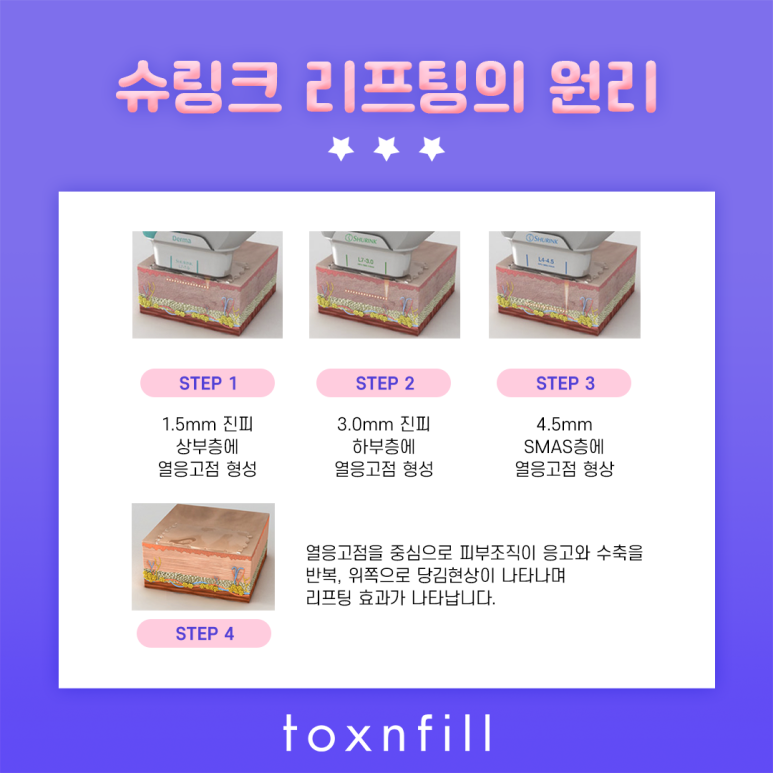 봉천동 피부 탄력 UP!! 슈링크 관련 이미지 3