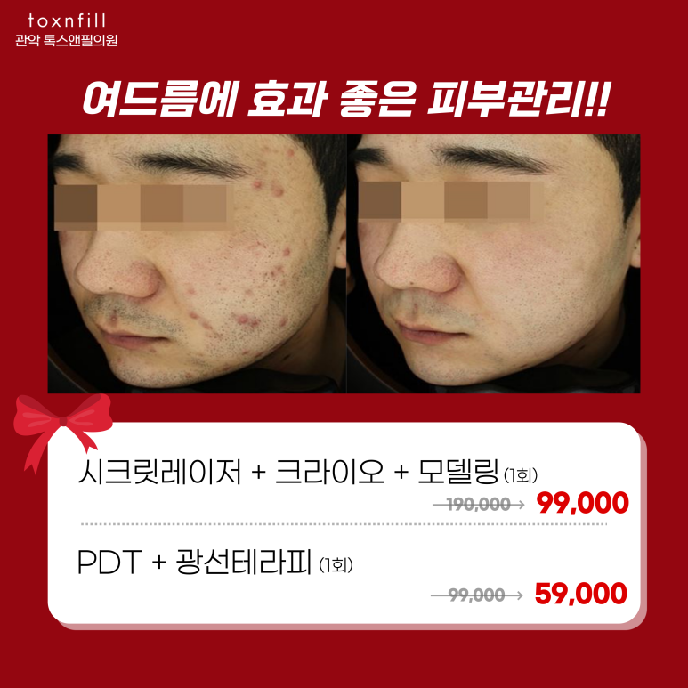 서울대입구역피부과 2022년 연말시술 이벤트!! 관련 이미지 6