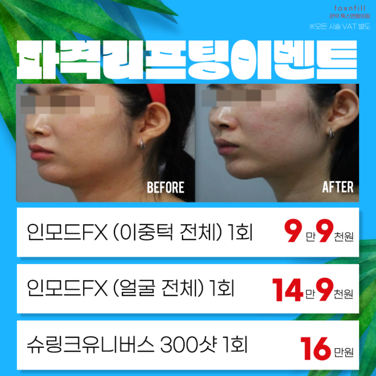 톡스앤필 서울대점 7월31일까지 여름나기 이벤트 돌입! 관련 이미지 5