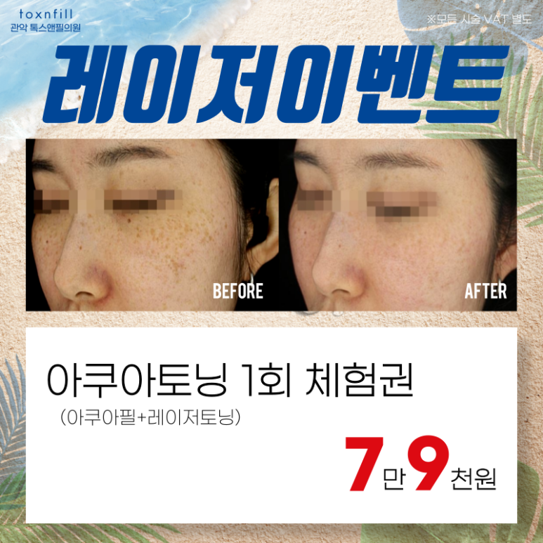 톡스앤필 서울대점만의 단 2주간 여름맞이 이벤트!! 관련 이미지 4