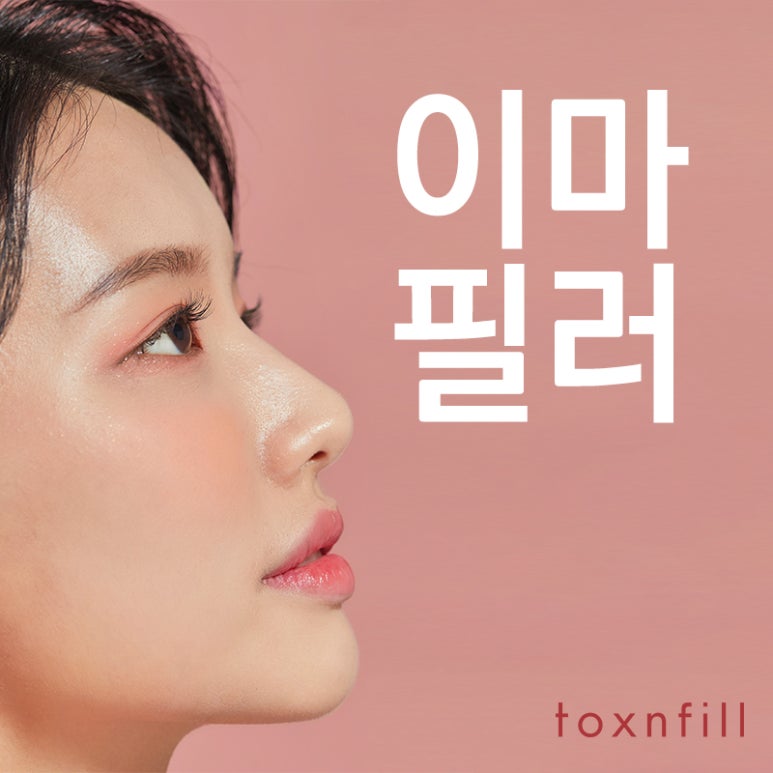 내 얼굴에 딱 맞는 이마필러 관련 이미지 1