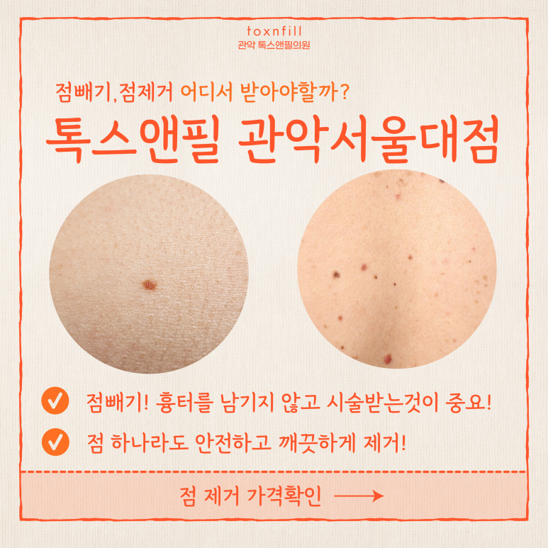 관악구 피부과에서 점제거,점빼기 효과만점 관련 이미지 4