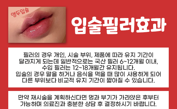 서울대입구 입술필러로 볼륨 가득 매력 넘치게! 관련 이미지 3