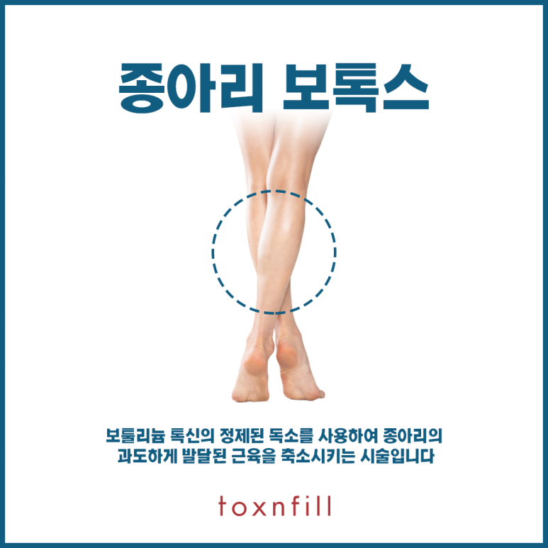 톡스앤필 종아리보톡스 관련 이미지 2