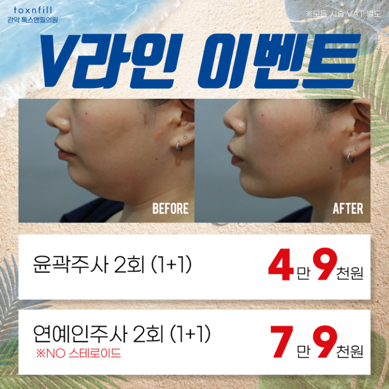 톡스앤필 서울대점만의 단 2주간 여름맞이 이벤트!! 관련 이미지 6