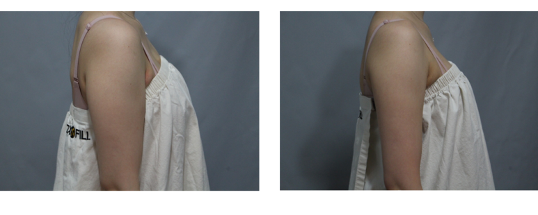 관악구피부과에서 추천하는 가장 핫하고 확실한 다이어트! 후기 관련 이미지 1