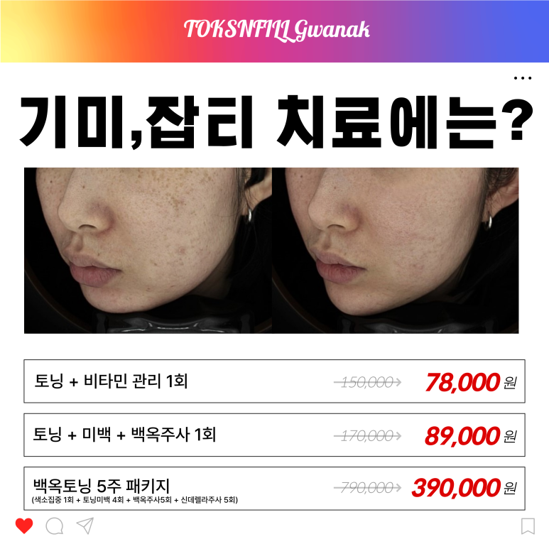 서울대입구역 피부과 2월 서울대점 단독 빅이벤트!! 관련 이미지 5