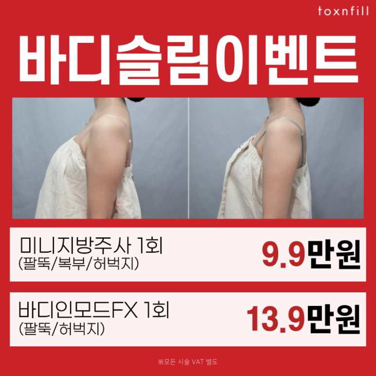 [~5/25] 모든 제모 할인 20% 행사 이벤트! 관련 이미지 5