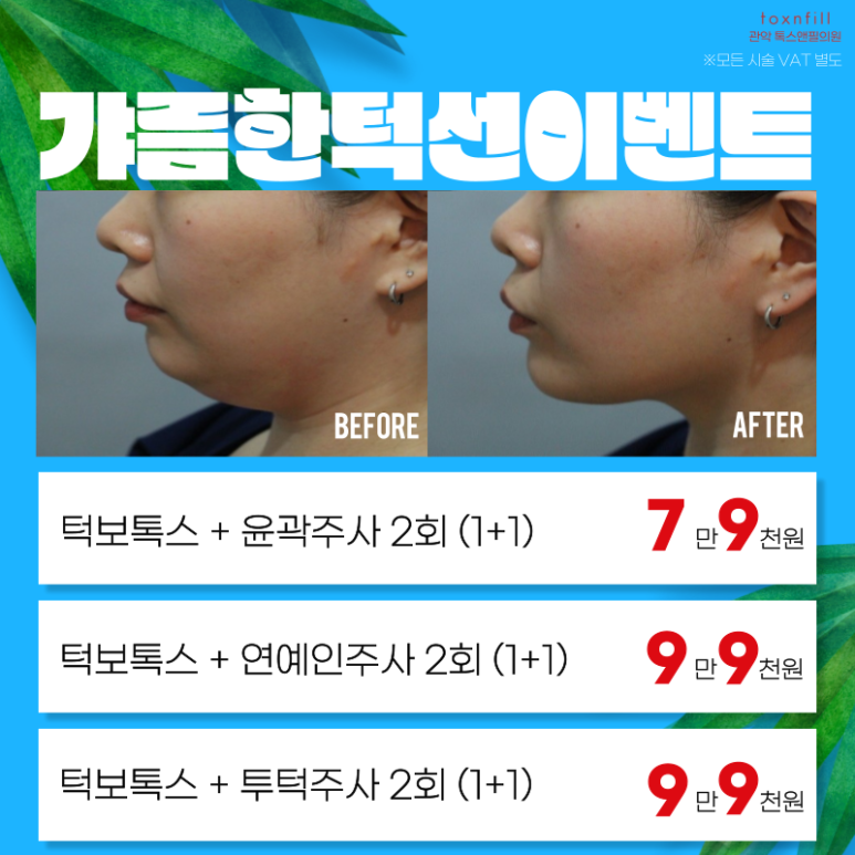 톡스앤필 서울대점 7월31일까지 여름나기 이벤트 돌입! 관련 이미지 4