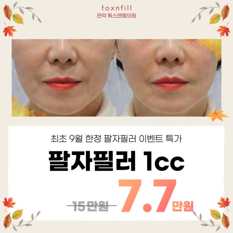 [톡스앤필관악점] 관악구피부과 톡스앤필서울대점에서 9월 한정 이마필러이벤트 실시!!! 관련 이미지 2