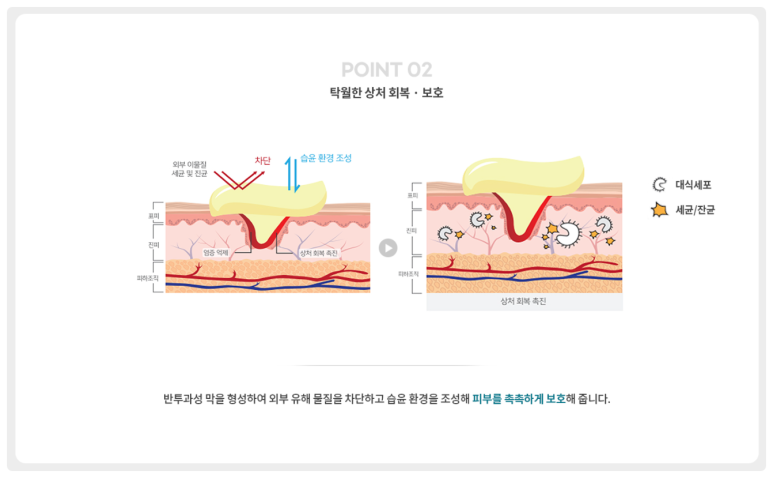 관악구피부과 키오머3 실비보험 가능한 스킨부스터(아토피 피부염 개선) 관련 이미지 11