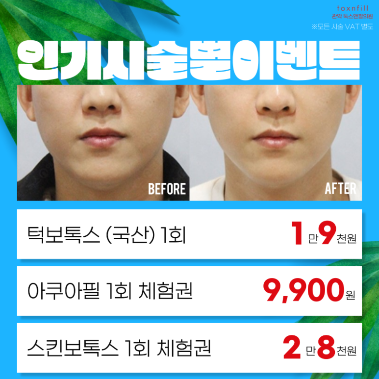 톡스앤필 서울대점 7월31일까지 여름나기 이벤트 돌입! 관련 이미지 6