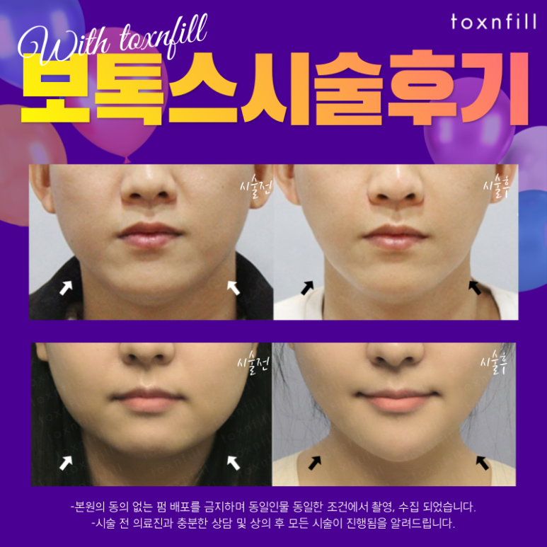 [특가혜택] 26일까지 할인된 가격으로 원하던 시술만나보세요!! 관련 이미지 3