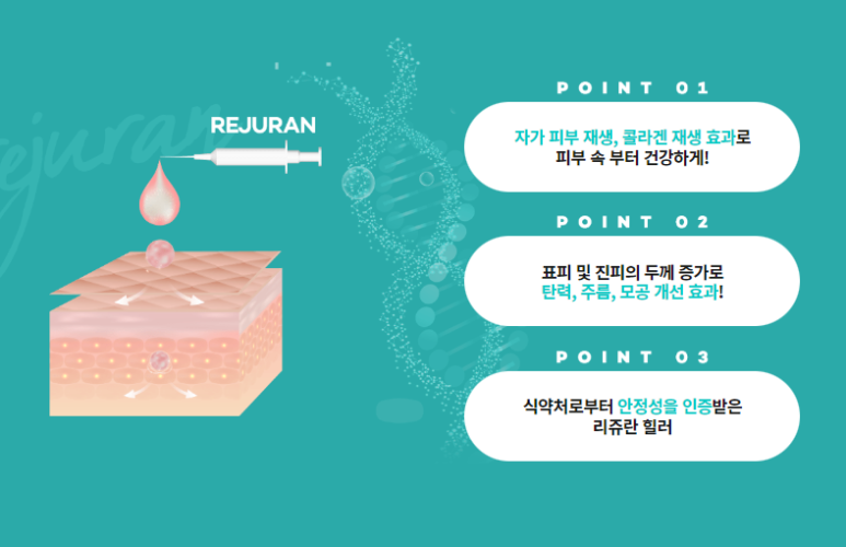 서울대입구역피부과에서 연예인만 받는 리쥬란힐러 시술받고 피부에 자신감되찾은 후기!(내돈내산) 관련 이미지 3