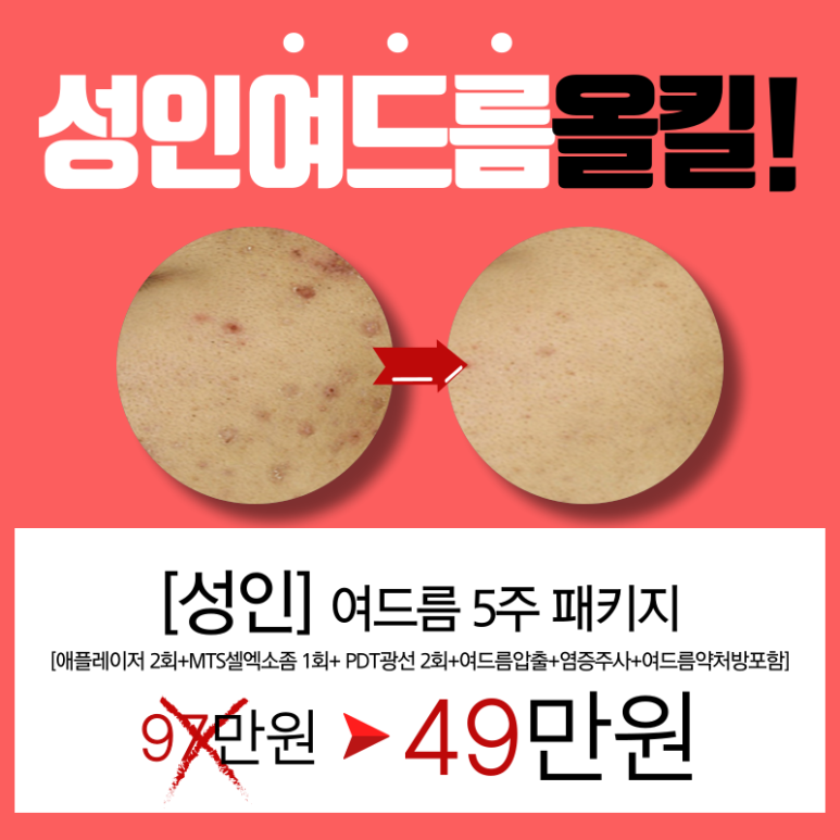 [Toxnfill Seoul National University Branch] Still dealing with adult acne..? Adult Acne All-Kill Package! image 1