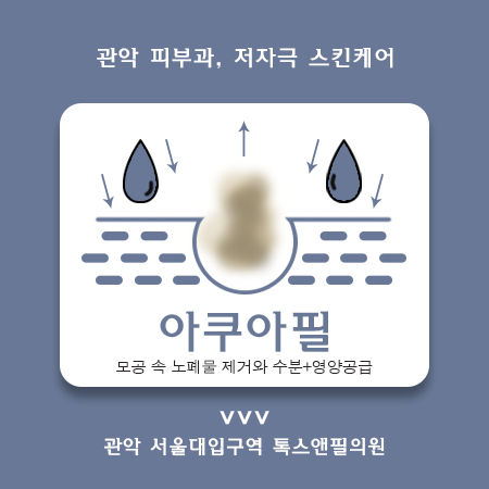 서울대입구아쿠아필 주기적인 관리가 필요한 이유 관련 이미지 1