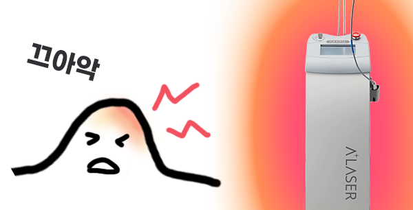 서울대입구역 여드름케어 애플레이저 애플토닝, 원인부터 해결하세요 관련 이미지 4