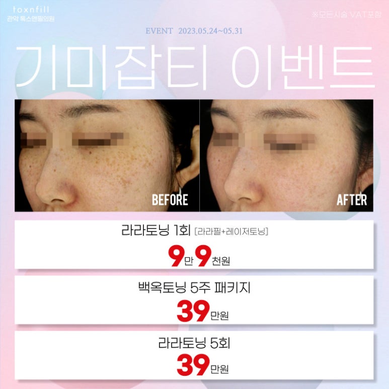 서울대입구 코필러 5월말까지의 다양한 시술 이벤트! 관련 이미지 4