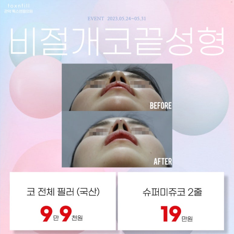 서울대입구 코필러 5월말까지의 다양한 시술 이벤트! 관련 이미지 3