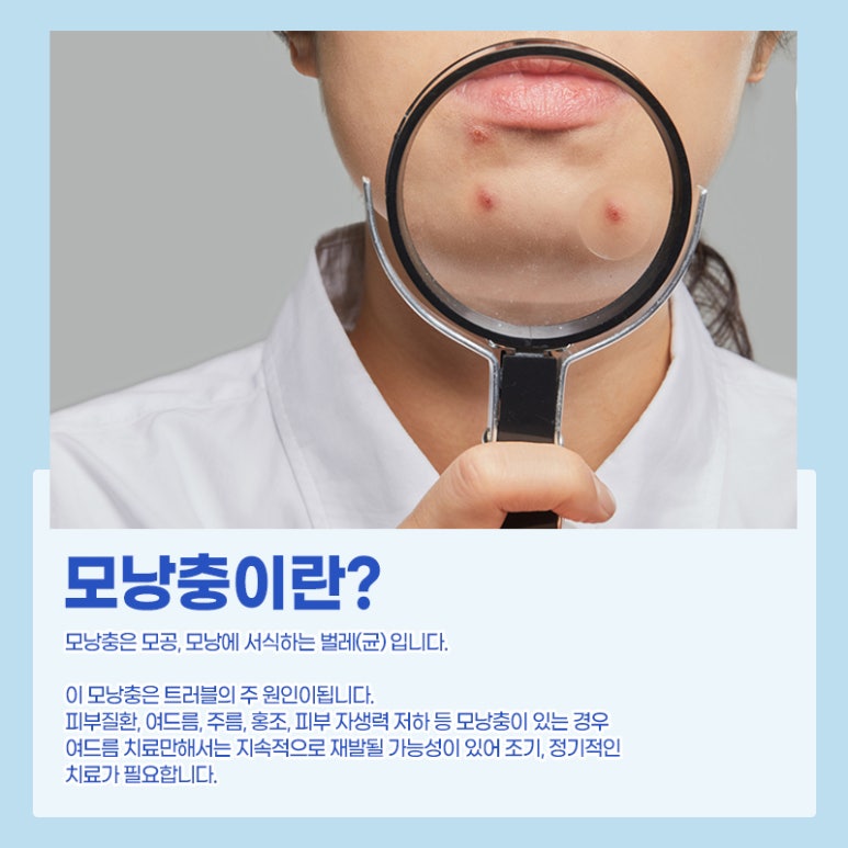 산뜻한 모공관리! 아쿠아필 관련 이미지 3