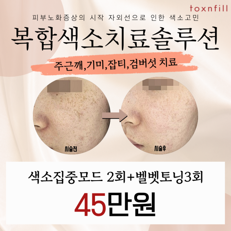 SNU Branch Pigment Signature Solution for Freckles and Age Spots image 1