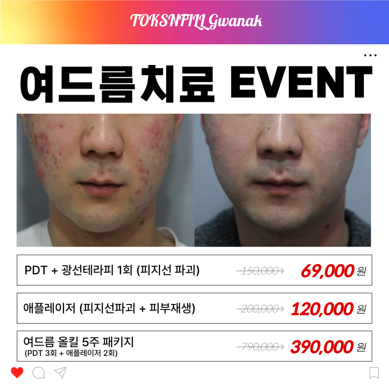 서울대입구역 피부과 2월 서울대점 단독 빅이벤트!! 관련 이미지 4