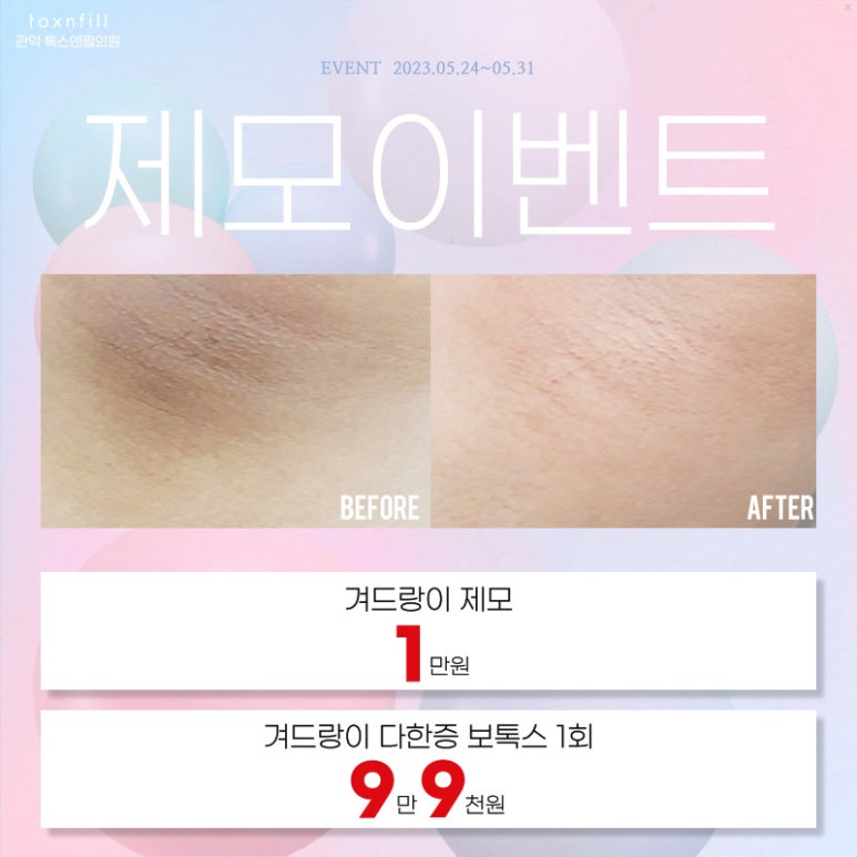 서울대입구 코필러 5월말까지의 다양한 시술 이벤트! 관련 이미지 2