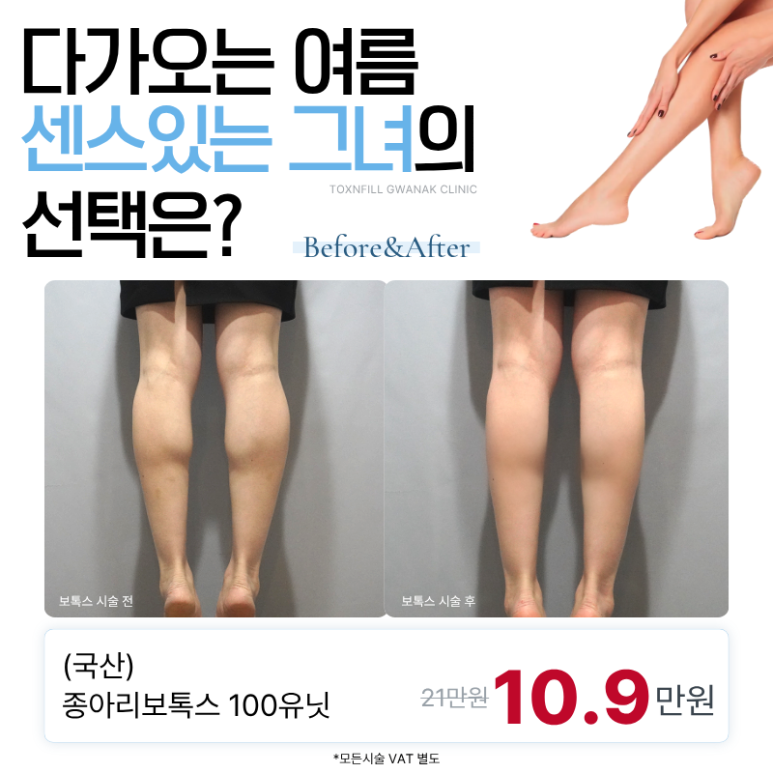 [Toxnfill Seoul National University Branch] Summer-Prep Calf Botox Body Toxin Event🌟 image 1