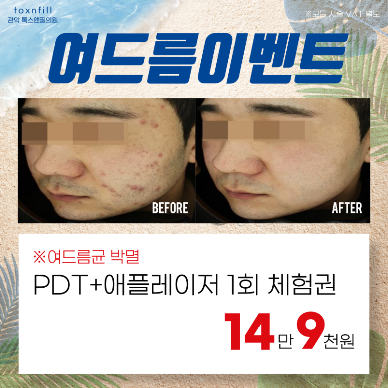 톡스앤필 서울대점만의 단 2주간 여름맞이 이벤트!! 관련 이미지 7