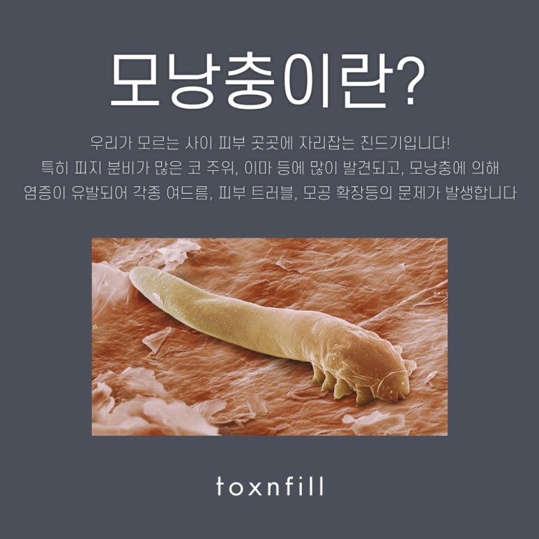 서울대입구역 아쿠아필링 관련 이미지 3