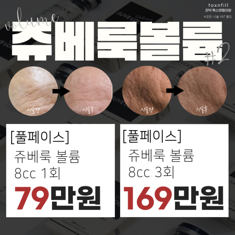 [톡스앤필 서울대점] 신규런칭 쥬베룩&볼륨이벤트!! 관련 이미지 7