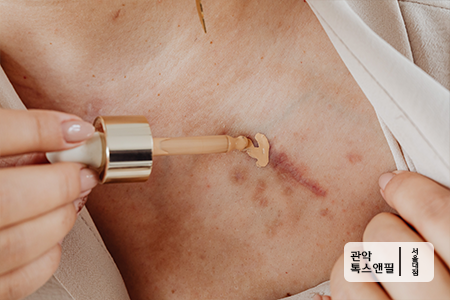 서울대입구역 점빼기. 점제거. 깨끗한 피부 만들기 관련 이미지 5