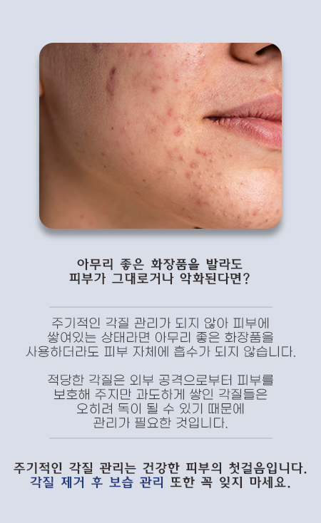 서울대입구아쿠아필 주기적인 관리가 필요한 이유 관련 이미지 3