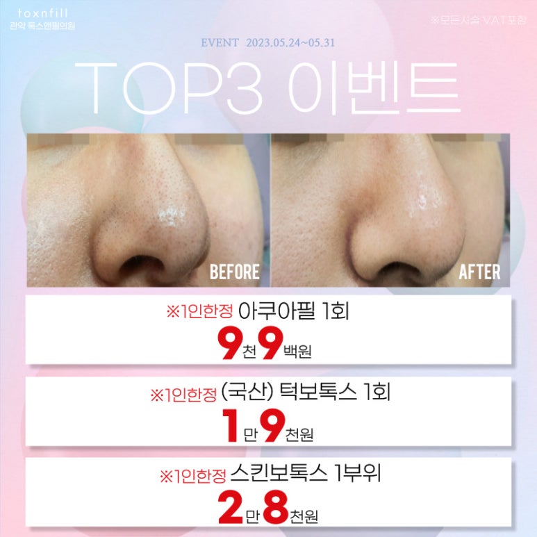 서울대입구 코필러 5월말까지의 다양한 시술 이벤트! 관련 이미지 6