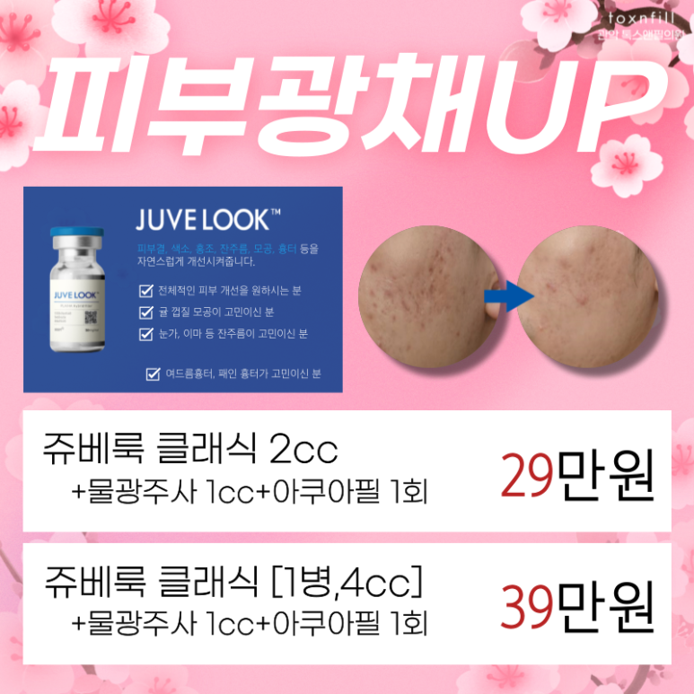 [톡스앤필서울대점] 4.2~4.13 봄맞이 이벤트 도입! 관련 이미지 6