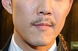 관악구피부과에 남자제모로 수염자국없앤 후기 관련 이미지 3