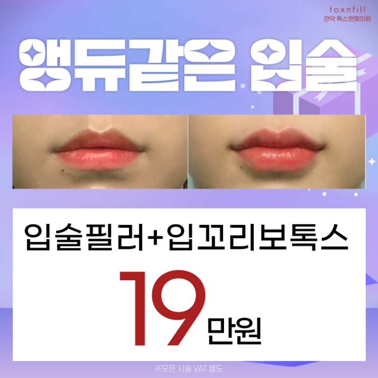 [톡스앤필 서울대점] 단, 5일간의 서울대점 빅이벤트! 관련 이미지 3