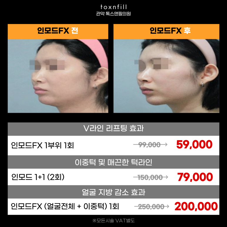 서울대입구역피부과 인모드로 얼굴라인 만들기 관련 이미지 6