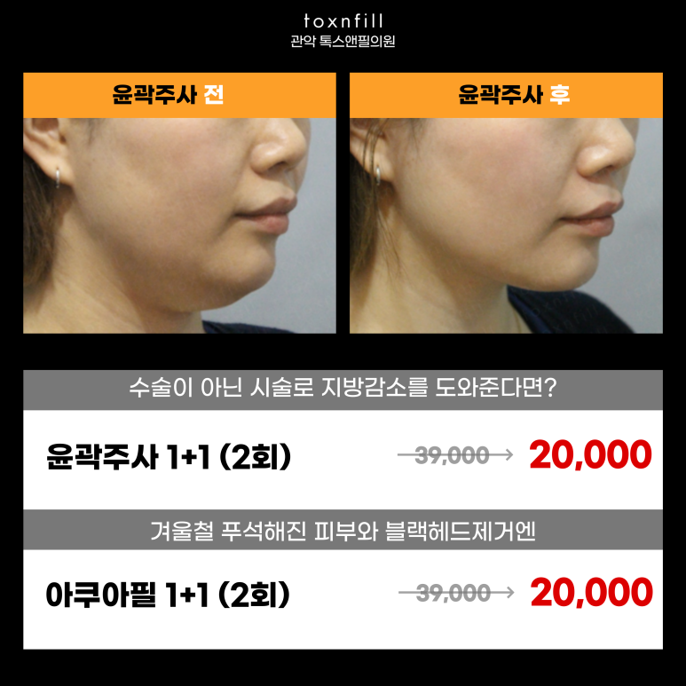 관악구피부과 윤곽주사 맞고 브이라인 얻고 관련 이미지 4