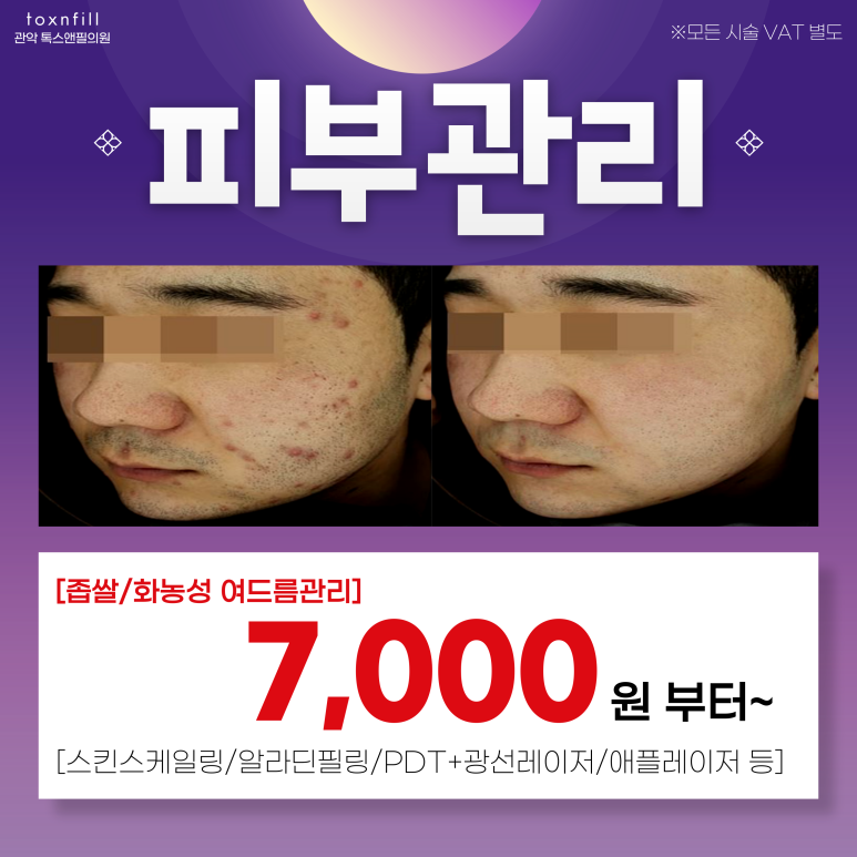 서울대입구 피부과 9월 추선대전 이벤트 시행! 관련 이미지 2