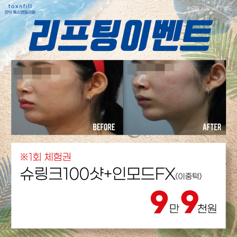 톡스앤필 서울대점만의 단 2주간 여름맞이 이벤트!! 관련 이미지 3