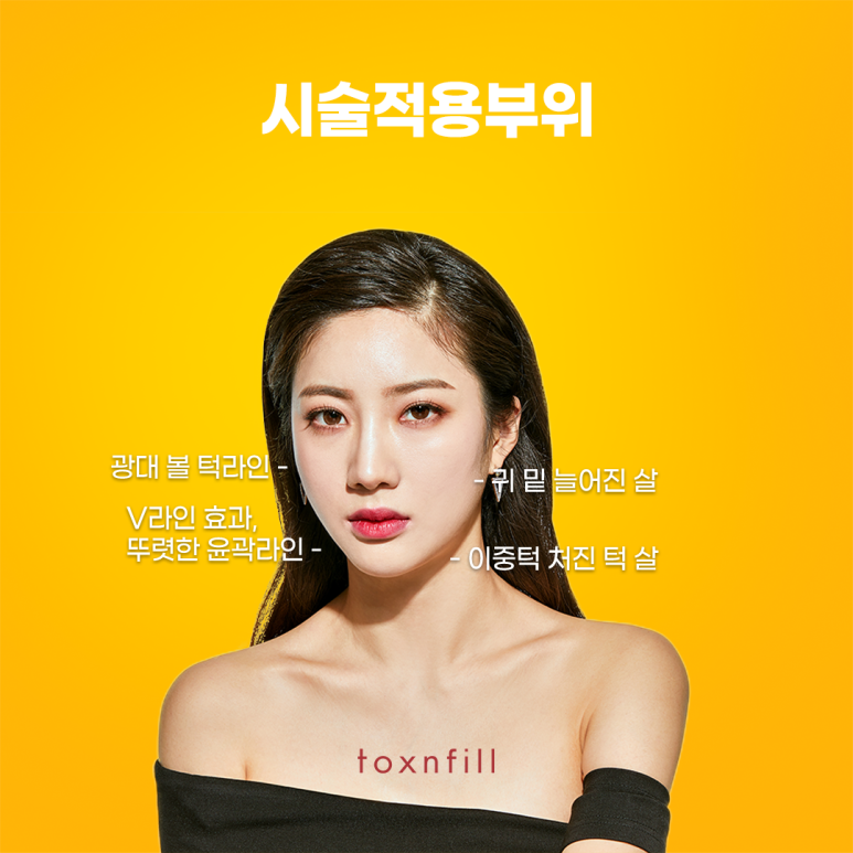 톡스앤필 프리미엄 연예인주사 관련 이미지 4