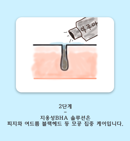 관악구 아쿠아필. 합리적 모공관리 관련 이미지 5