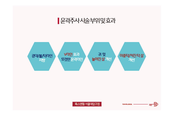 윤곽라인 개선 서울대입구피부과 윤곽주사 관련 이미지 3
