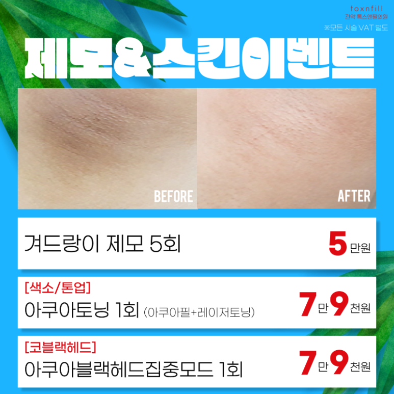 톡스앤필 서울대점 7월31일까지 여름나기 이벤트 돌입! 관련 이미지 7