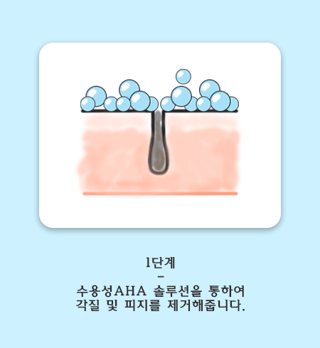 관악구 아쿠아필. 합리적 모공관리 관련 이미지 4